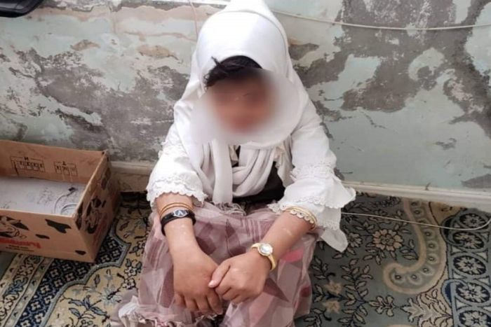 طفلة يمنية تعرضت للتعذيب الوحشي على يد أبيها وأقربائها حتى فقدت النظر ثم بيعت ب200 ألف ريال