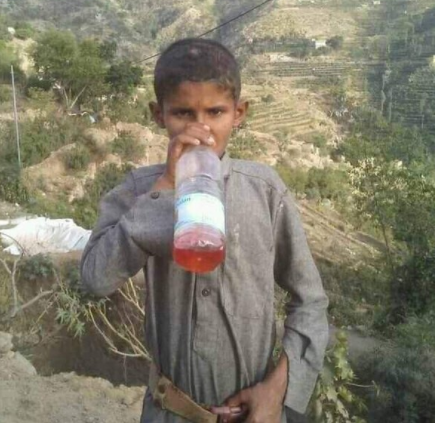  في حالة نادرة.. طفل يعمل بالوقود في محافظة حجة