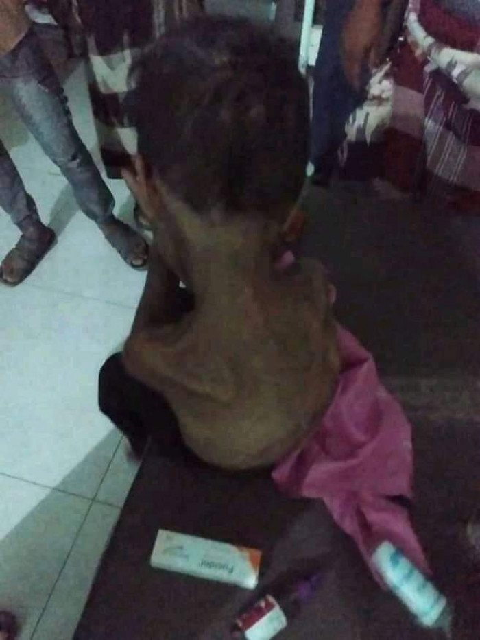 تعز.. حبس طفل من قبل والده داخل حمام منزله مدة أشهر