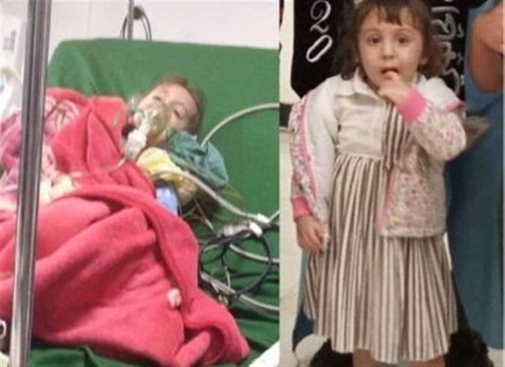عملية بسيطة تتسبب بوفاة طفلة في عدن بعد أيام من فقدانها لبصرها