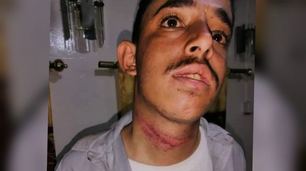 شاهد..تفاصيل جريمة مروعة ضد (أغبري ) جديد تعرض للتعذيب الشديد على مرئ ومسمع الحوثيين في صنعاء