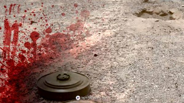 استشهاد وإصابة طفلين في انفجار لغم حوثي في البيضاء