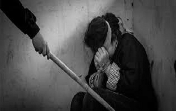 أب يقتل طفله بالتعذيب الشديد والحرق بالماء الحار في الحديدة