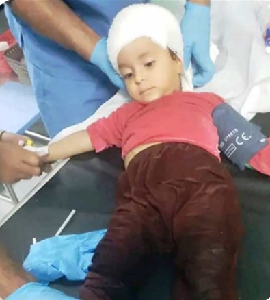 إصابة 3 أطفال بانفجار مقذوف شمالي الضالع
