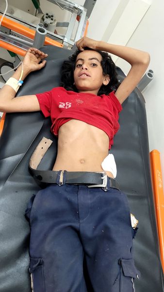 استشهاد طفل وإصابة ابن عمه برصاص قناص حوثي في تعز