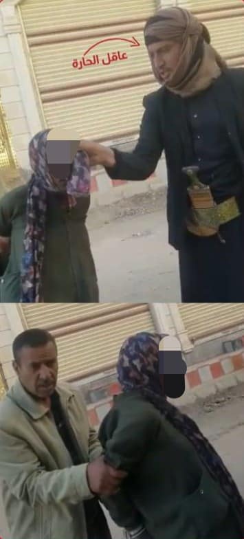 ماحقيقة الفتاة اليمنية التي ظهرت تشرب دماء الكلاب؟