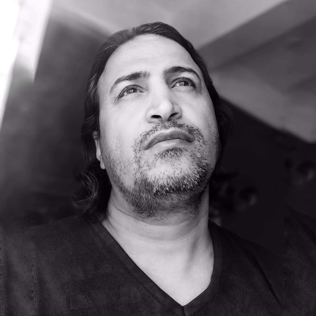 ٳصابة رشاد السامعي ٲشهر كاركاتير يمني في ٳحدى عينيه(صورة) 