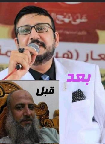 شاهد قبل و بعد.. كيف تحول قيادي حوثي بارز بعد اجراء عمليات تجميل