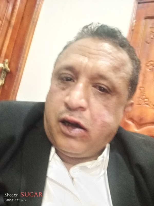 الاتحاد العام للإعلاميين اليمنيين يدين الاعتداء على الصحفي الصمدي في صنعاء
