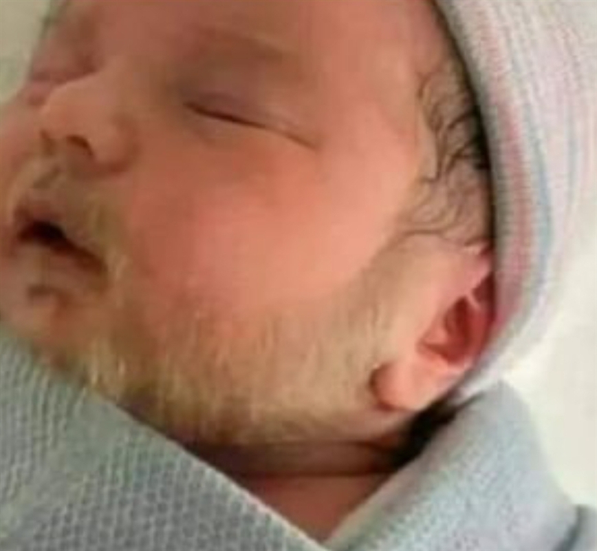 حقيقة ولادة طفل بلحية بيضاء في الجوف
