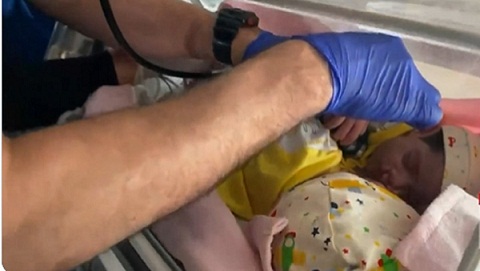 بدء عملية فصل التوأم السيامي اليمني "مودة ورحمة"