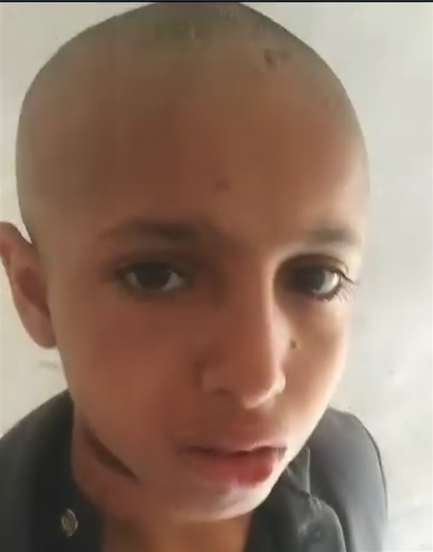 طفل يمني يفر من أسرته بعد تعرضه للتعذيب وإنهاء شقيقه لحياته
