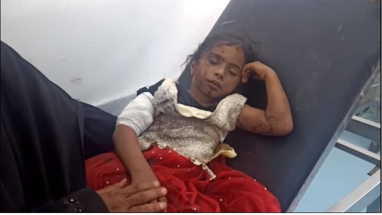 الحديدة.. لغم حوثي يصيب 7 أشخاص من أسرة واحدة بينهم 4 أطفال
