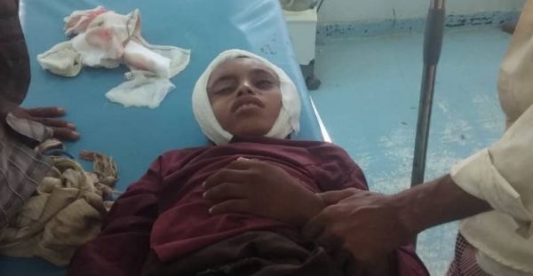 الحديدة.. إصابة طفل في رأسه برصاصة قناص حوثي